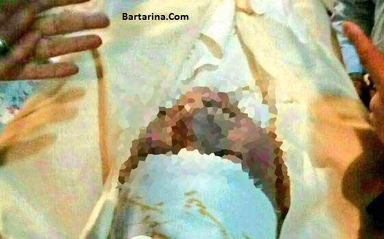 عکس جسد مرحوم هاشمی رفسنجانی شایعه تا واقعیت + کبودی جنازه
