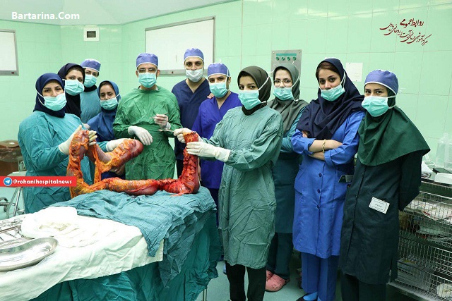 فیلم خارج کردن روده 5 کیلویی از شکم خانم 52 ساله بابلسری