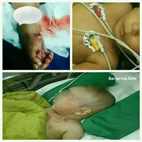 کودک آزاری پسر 15 ماهه با چاقو در ایزدآباد سیرجان + عکس