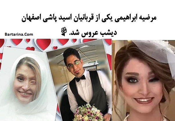 فیلم عروسی مرضیه ابراهیمی قربانی اسیدپاشی اصفهان شهریور 96