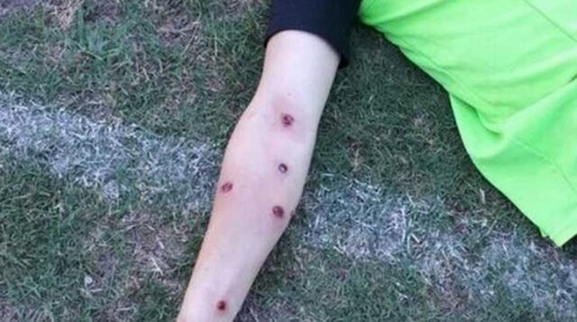 به گلوله بستن بازیکنان و هواداران فوتبال در آرژانتین (18+)