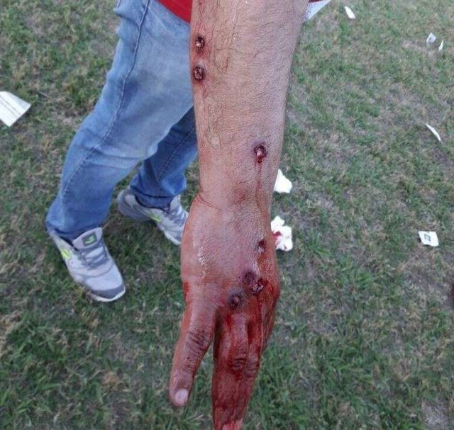 به گلوله بستن بازیکنان و هواداران فوتبال در آرژانتین (18+)