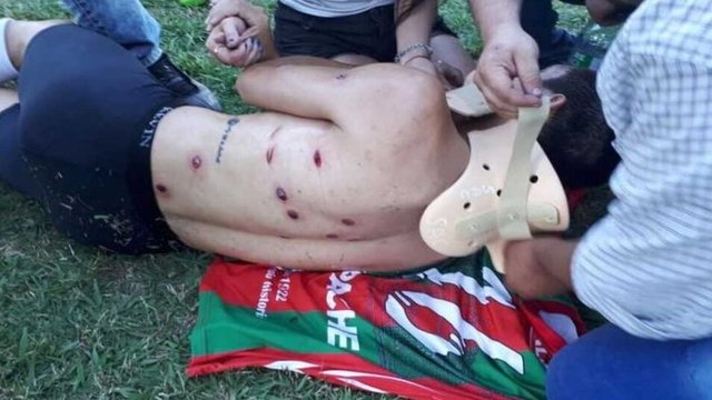 به گلوله بستن بازیکنان و هواداران فوتبال در آرژانتین (18+)